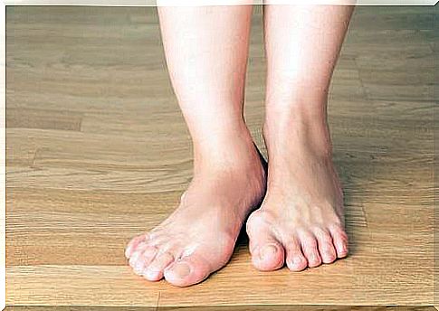 What are bunions?