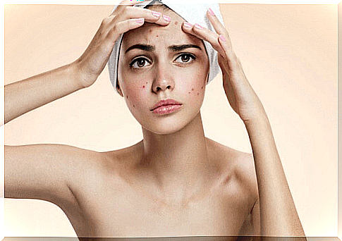 Beauty treatments with tomato to fight acne