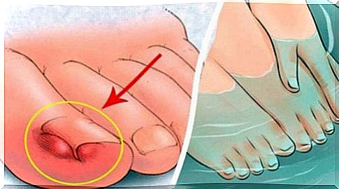 6 home remedies for ingrown toenails