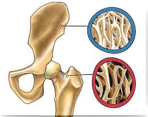 Bones that tell us about osteoporosis