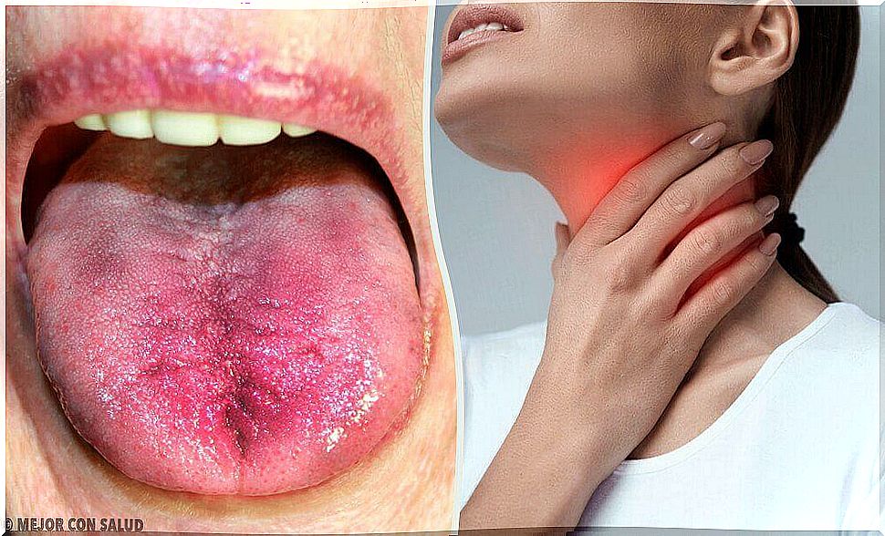 6 ways to know if there is white plaque in your throat