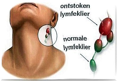 Check the lymph nodes in your neck