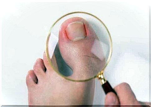 Big toe under a magnifying glass