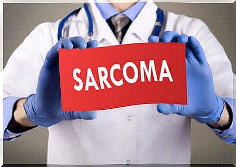 Different types of sarcomas and their characteristics