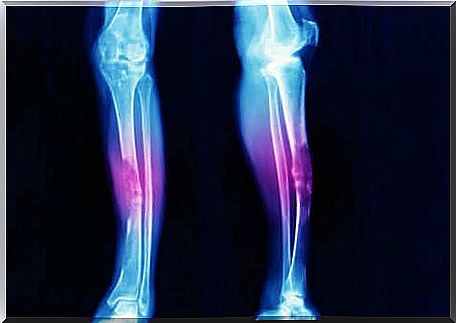 An X-ray of a pair of legs