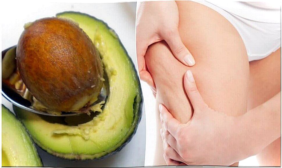 How can you use an avocado pit to treat cellulite?