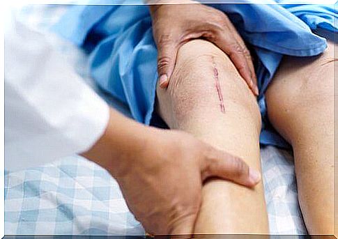 How to recover after knee surgery