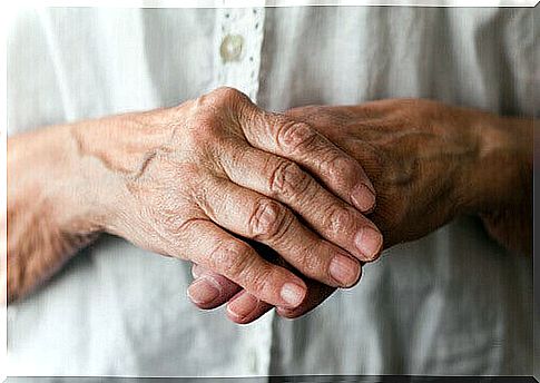 hands with arthritis