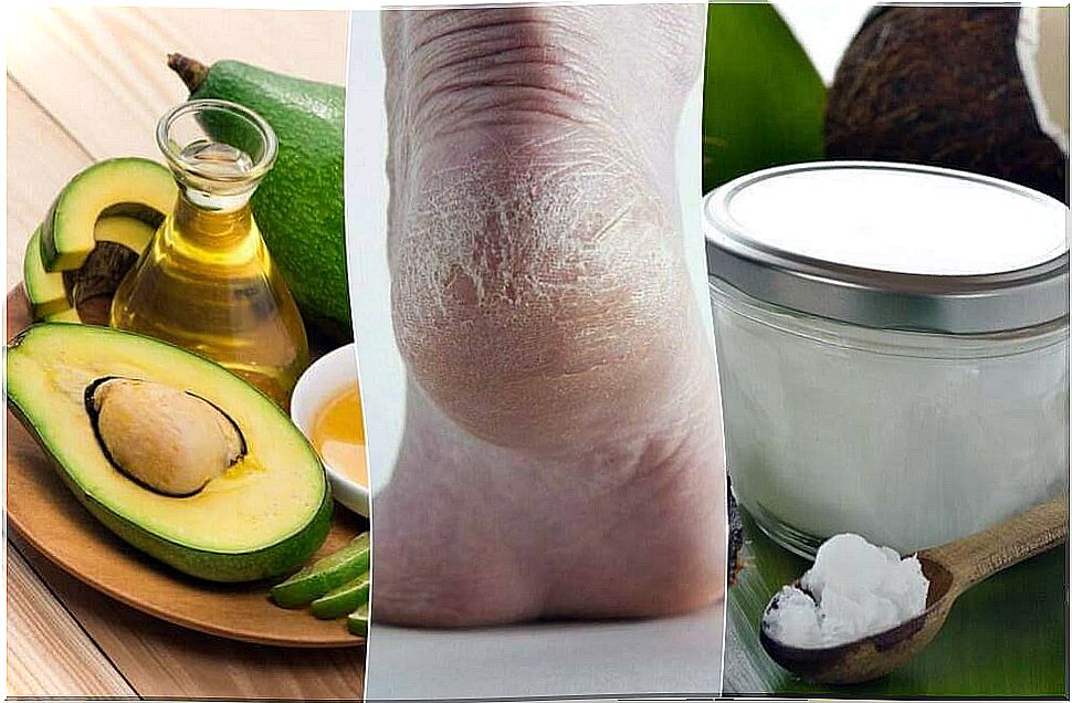 Moisturize your cracked heels with these 5 creams