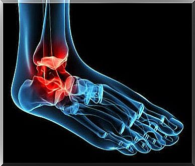 Painful Ankle Joint