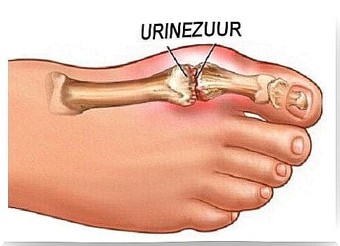 uric acid