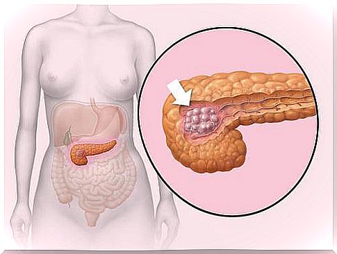 Tips for a healthier pancreas