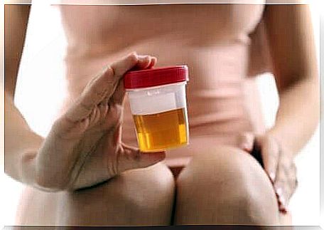 A patient collecting the urine sample