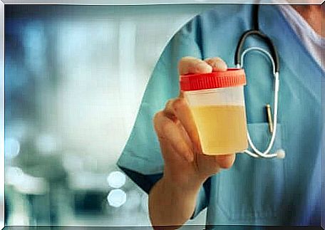 Doctor holding a urine sample