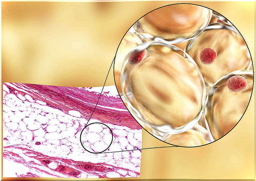 Adiponectin is a protein