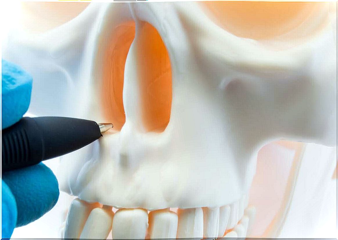 A skull with a deviated septum